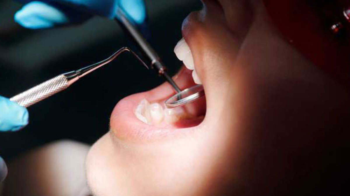Why Do Dentists Poke at Your Gums and Say Numbers? - Bite Dentistry